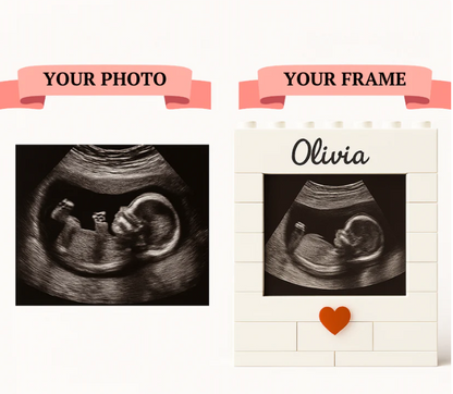 Personalized Ultrasound Bricks